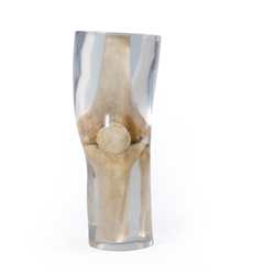 ERLER ZIMMER X-ray Phantom Knee (Transparent)