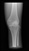 ERLER ZIMMER X-ray Phantom Knee (Opaque)