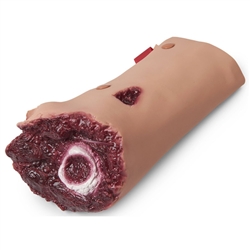 Nasco Simulaids Life Moulage Wound, Leg Amputation Simulator - Light