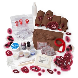 Nasco Simulaids Multiple Casualty Wound Simulation Kit - Dark