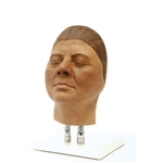 Erler Zimmer Head for Facial Injections, Version F