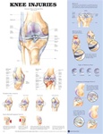 Knee Injuries Anatomical Chart
