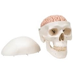 3B Scientific Classic Human Skull Model with 8 Part Brain Smart Anatomy