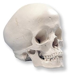Hydrocephalic Human Skull Model