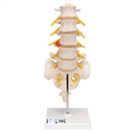 3B Scientific Human Lumbar Spinal Column Model with Dorso-Lateral Prolapsed Intervertebral Disc Smart Anatomy