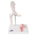 3B Scientific Mini Human Hip Joint Model with Cross Section Smart Anatomy