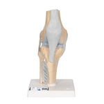 3B Scientific Sectional Human Knee Joint Model, 3 Part Smart Anatomy