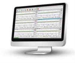 Central Station Software For 64 Fetal Monitors