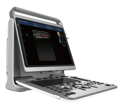 Chison EBit 50 Diagnostic Ultrasound System