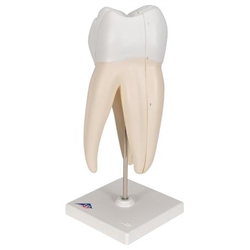 3B Scientific Upper Triple-Root Molar Human Tooth Model, 3 Part Smart Anatomy