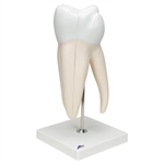3B Scientific Giant Molar with Dental Cavities Human Tooth Model, 15 Times Life-Size, 6 Part Smart Anatomy