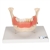 3B Scientific Dental Disease Model, Magnified 2 Times, 21 Parts Smart Anatomy