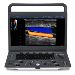 SonoScape E2 Color Portable Digital Ultrasound System