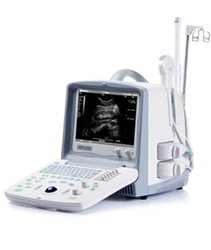 EMP-2100 Digital Ultrasonic Diagnostic Imaging System