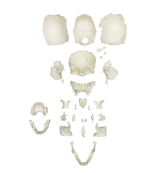 ERLER ZIMMER Disarticulated Human Medical Study Skull