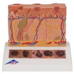 3B Scientific Skin Cancer Model with 5 Stages, 8 Times Magnified Smart Anatomy