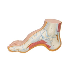 3B Scientific Hollow Foot (Pes Cavus) Model Smart Anatomy