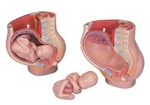 MEDart™ Pregnancy Pelvis