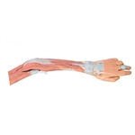 Erler Zimmer Upper Limb - Elbow, Forearm and Hand
