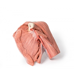 Erler Zimmer Shoulder (Left) - Superficial Muscles and Axillary/Brachial Artery