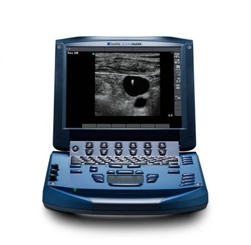 Sonosite Micromaxx Portable Ultrasound Machine - MSK (Refurbished)