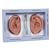 3B Scientific 3B Ear Set, One Left and Right Ear