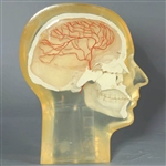 RSD Transparent Half Angiographic Head Phantom with Step Wedge & Resolution Test Pattern (2-10 lp/mm)