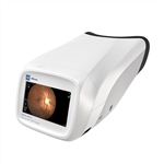 Welch Allyn RetinaVue 700 Imager, Diabetic retinopathy screening