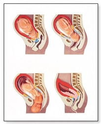 The Birth Process Chart (No Rods)