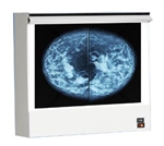 Mammography Viewbox