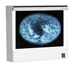 Mammography Viewbox