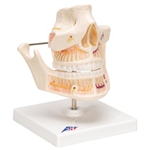 3B Scientific Adult Denture Model with Nerves and Roots Smart Anatomy