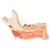 3B Scientific Comprehensive Lower Jaw Model (Left Half) with Diseased Teeth, Nerves, Vessels & Glands, 19 Part Smart Anatomy