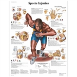 3B Scientific Sports Injuries Chart