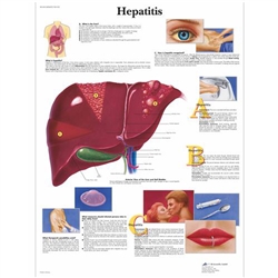 3B Scientific Hepatitis Chart