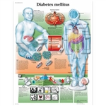 3B Scientific Diabetes Mellitus Chart