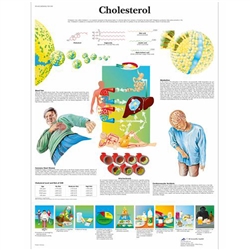 3B Scientific Cholesterol Chart