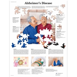 3B Scientific Alzheimer's Disease Chart