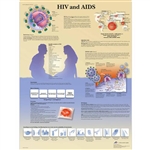 3B Scientific HIV and AIDS Chart