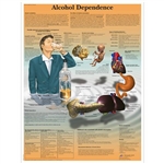 3B Scientific Alcohol Dependence Chart