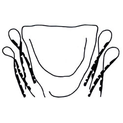5871 Complete Body Gasket Set (Sedans '68-on)