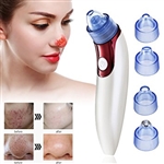 Electric Blackhead Suction Vacuum As Seen on TV