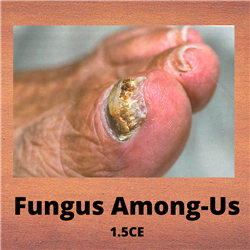 Fungus Among-Us - 1.5CE - $37.50