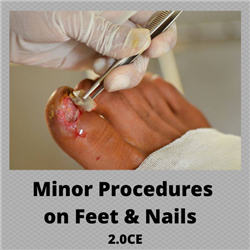 Minor Procedures on Feet and Nails - 2 CE Credits