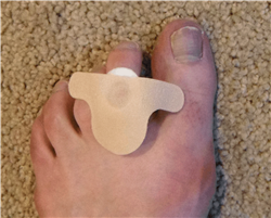 photo of toe shield bandage