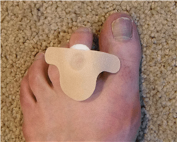 photo of toe shield bandage