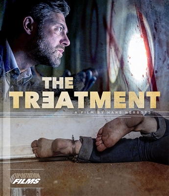 Treatment 01/17 Blu-ray (Rental)