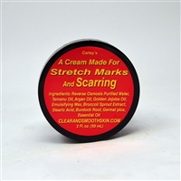 A Cream Made for Stretch Marks and Scarring