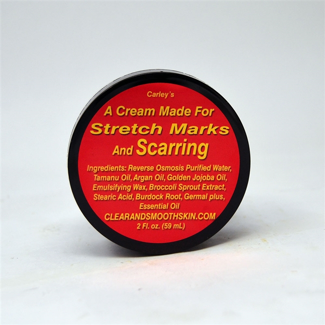 A Cream Made for Stretch Marks and Scarring