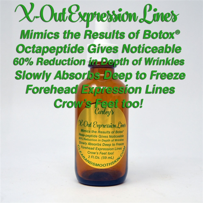 X-Out Expression Lines (Mimics BotoxÂ®)